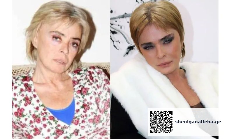 “13 წლისა გავთხოვდი; მშობლები ჩემ წასაყვანად რომ მოვიდნენ, გამოვაცხადე, ფეხს არ მოვიცვლი-მეთქი… პირველი ბავშვი 14 წლისას შემეძინა, 40 წლისას აღარც შვილები მყავდა და აღარც ქმარი” – მსახიობ ნინო ხომასურიძის ისტორია | შენი განათლება