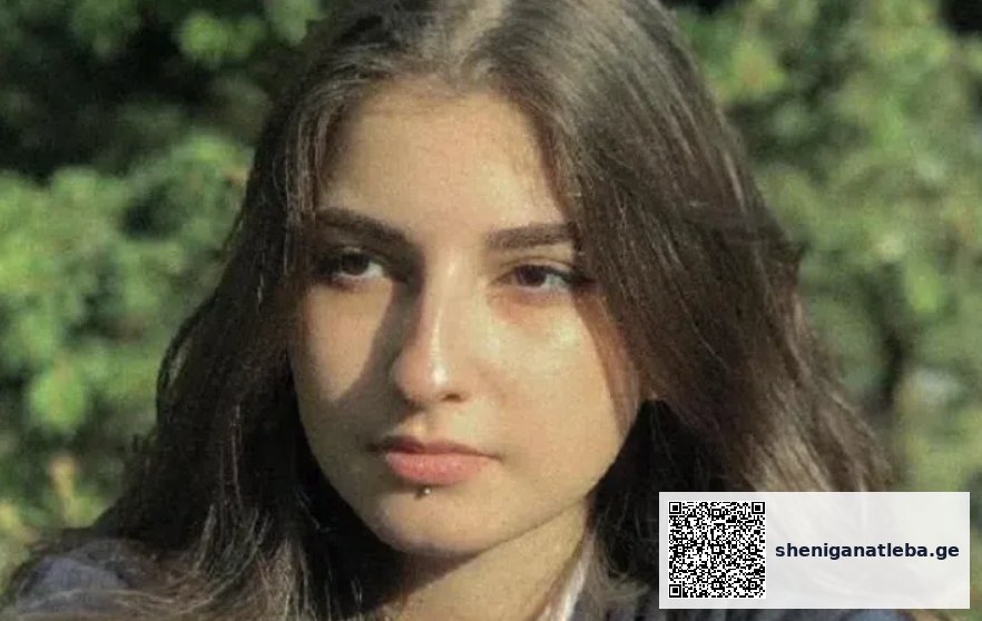 “13 წლის ასაკ­ში სა­ო­ცა­რი ოპე­რა­ცია ჩა­მი­ტარ­და… ინსულტით გარდაცვლილი, 26 წლის მამაკაცის გული გადამინერგეს” – 21 წლის ქართველი გოგონას მძიმე ისტორია | შენი განათლება